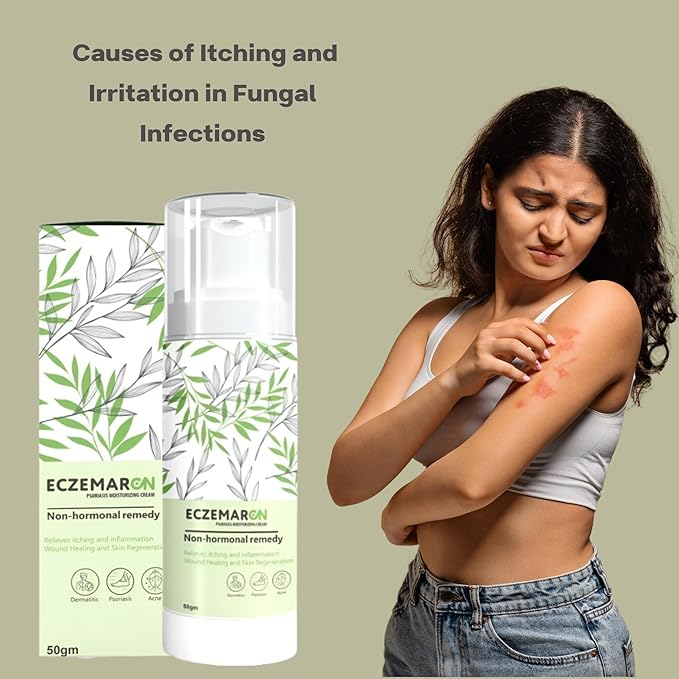 Eczemaron Anti Fungal Cream 50gm | Buy 1 Get 1 Free | ⭐️⭐️⭐️⭐️ 4.9/5 Reviews